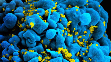Photo of Descubren una variante más contagiosa y agresiva del HIV
