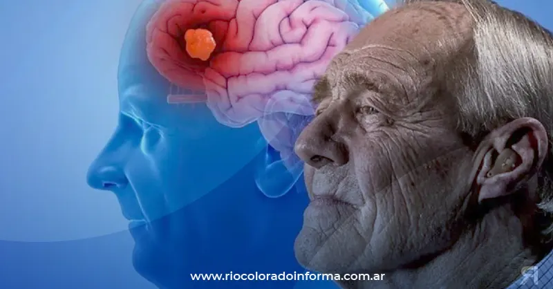 Photo of Día Mundial del Alzheimer: es clave mantener activa la memoria activa y consultar al neurólogo ante la aparición de síntomas